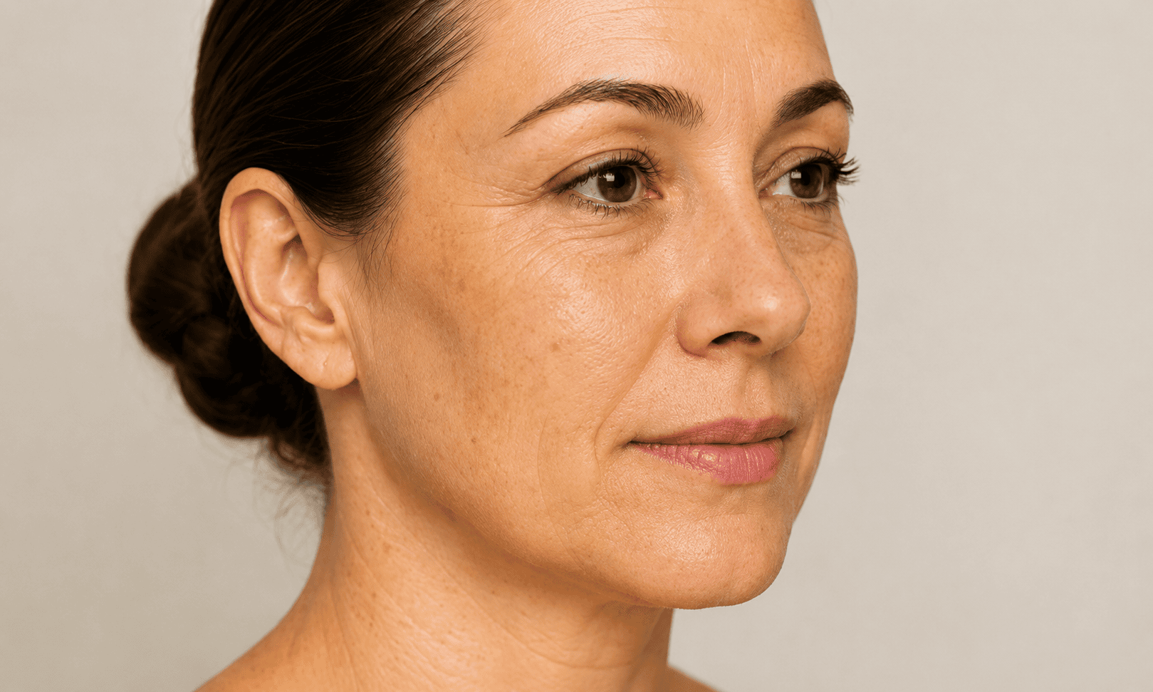 After hair restoration treatment